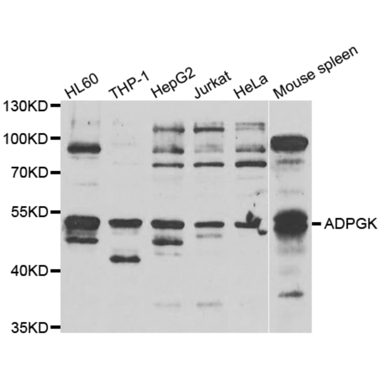 Western Blot - Anti-ADPGK Antibody (A7172) - Antibodies.com