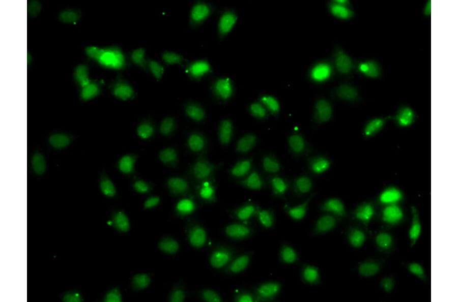 Immunofluorescence - Anti-Bcl6 Antibody (A15573) - Antibodies.com