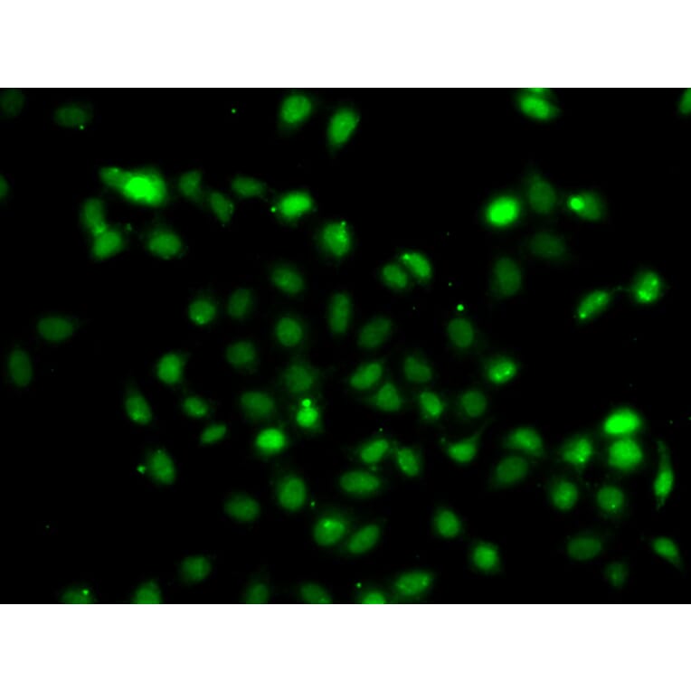 Immunofluorescence - Anti-Bcl6 Antibody (A15573) - Antibodies.com