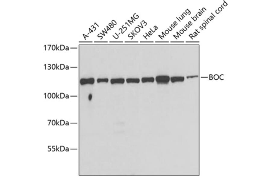 Western Blot - Anti-BOC Antibody (A15574) - Antibodies.com