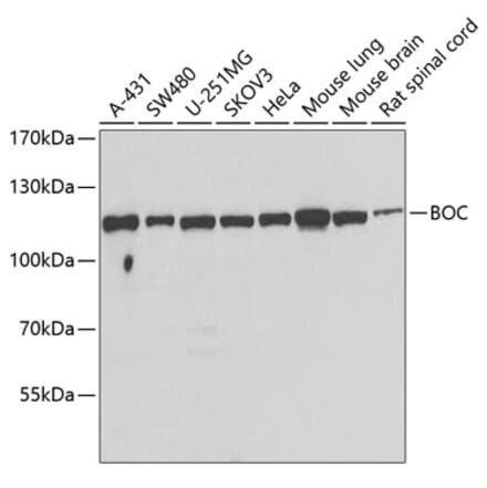 Western Blot - Anti-BOC Antibody (A15574) - Antibodies.com
