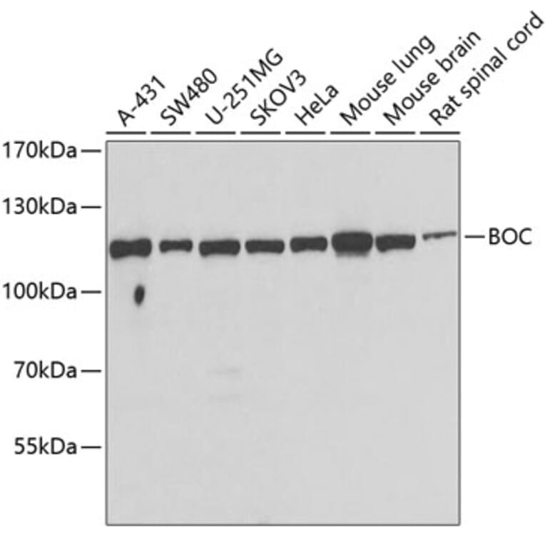 Western Blot - Anti-BOC Antibody (A15574) - Antibodies.com