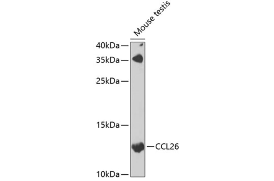 Western Blot - Anti-TSC-1 Antibody (A15575) - Antibodies.com