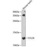 Western Blot - Anti-TSC-1 Antibody (A15575) - Antibodies.com