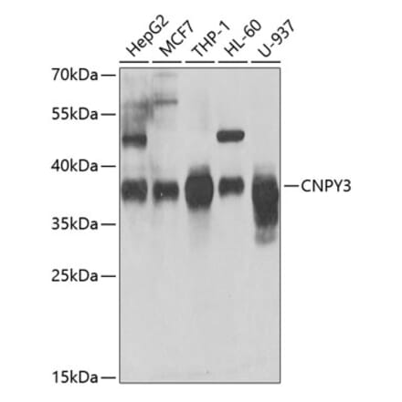 Western Blot - Anti-TNRC5 Antibody (A15576) - Antibodies.com