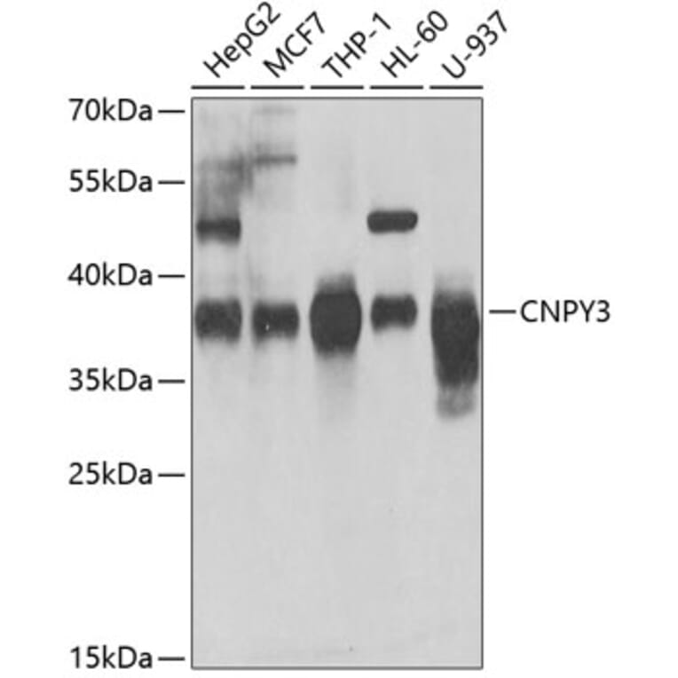 Western Blot - Anti-TNRC5 Antibody (A15576) - Antibodies.com