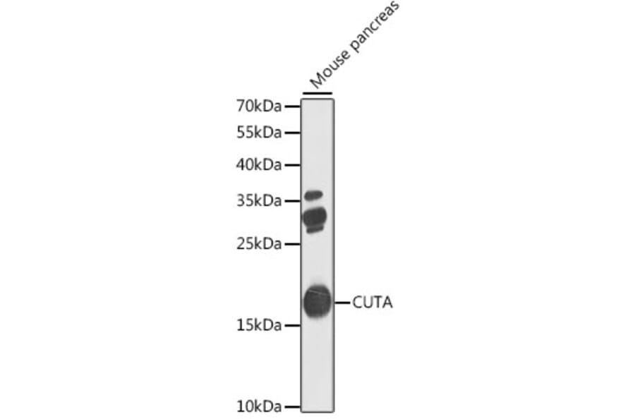 Western Blot - Anti-CUTA Antibody (A7178) - Antibodies.com