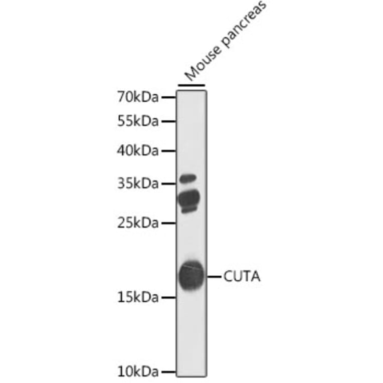 Western Blot - Anti-CUTA Antibody (A7178) - Antibodies.com
