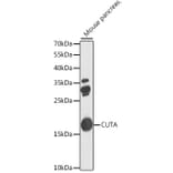 Western Blot - Anti-CUTA Antibody (A7178) - Antibodies.com