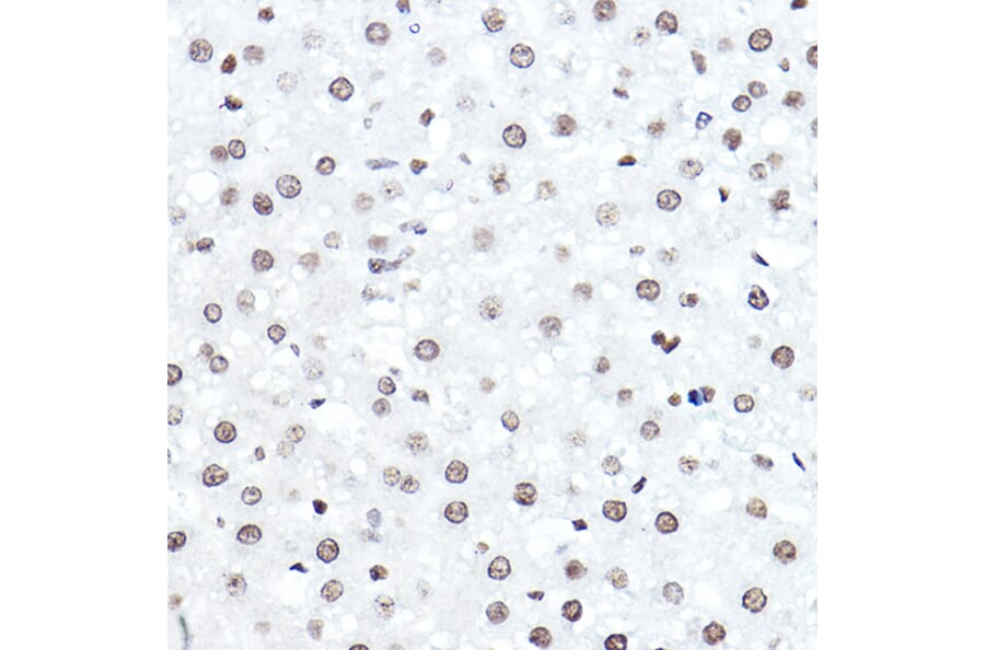 Immunohistochemistry - Anti-ELF5 Antibody (A15578) - Antibodies.com