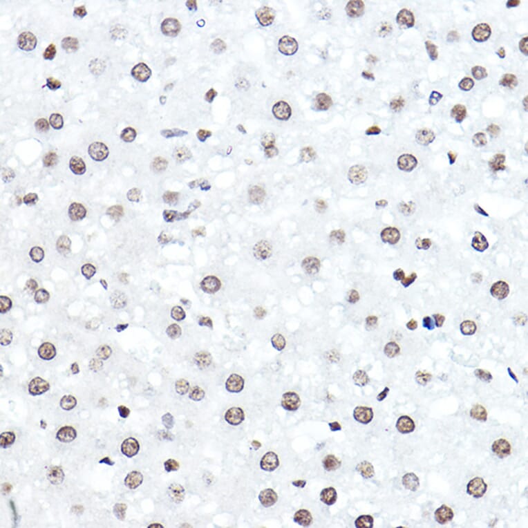 Immunohistochemistry - Anti-ELF5 Antibody (A15578) - Antibodies.com