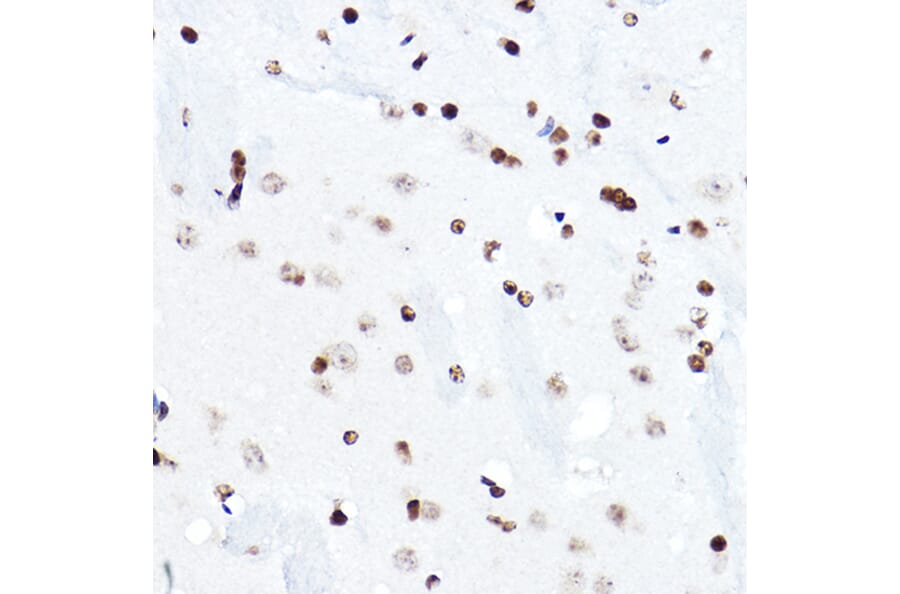 Immunohistochemistry - Anti-ELF5 Antibody (A15578) - Antibodies.com