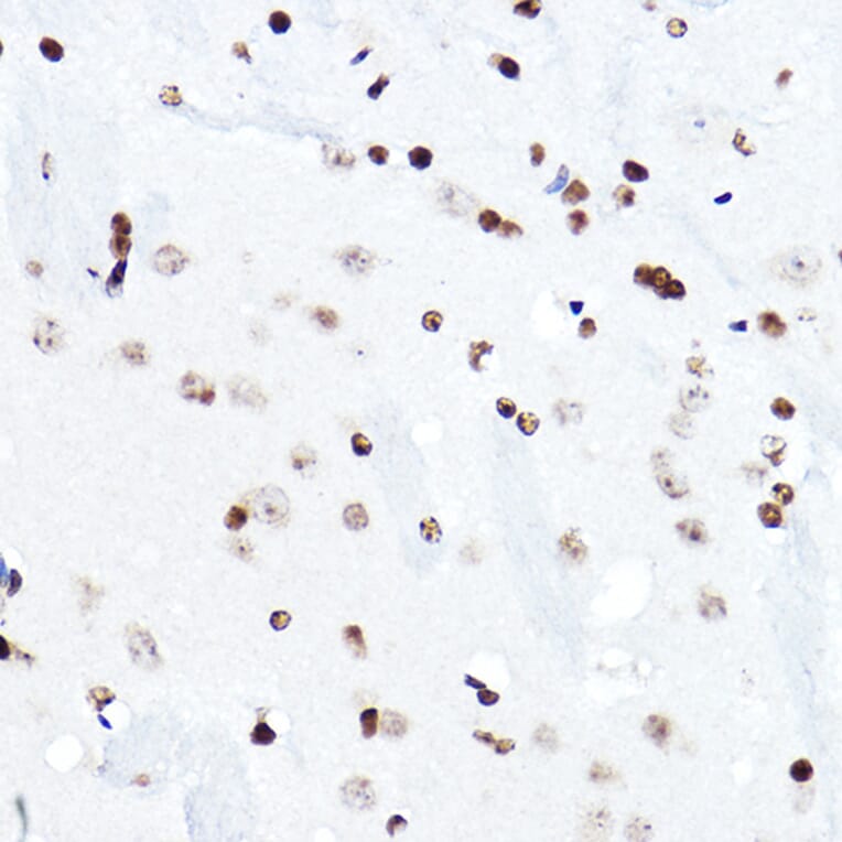 Immunohistochemistry - Anti-ELF5 Antibody (A15578) - Antibodies.com