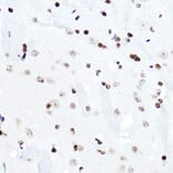 Immunohistochemistry - Anti-ELF5 Antibody (A15578) - Antibodies.com