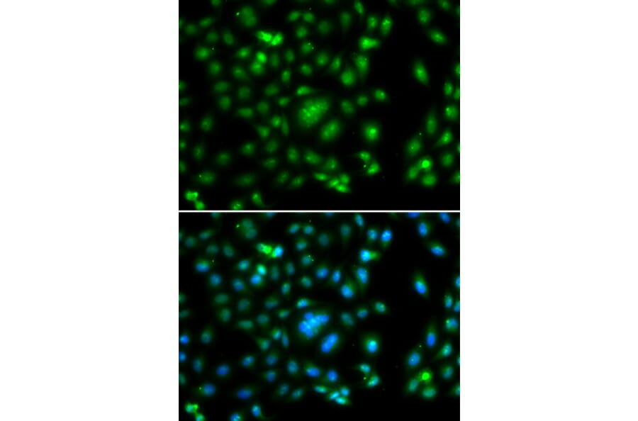 Immunofluorescence - Anti-ELF5 Antibody (A15578) - Antibodies.com