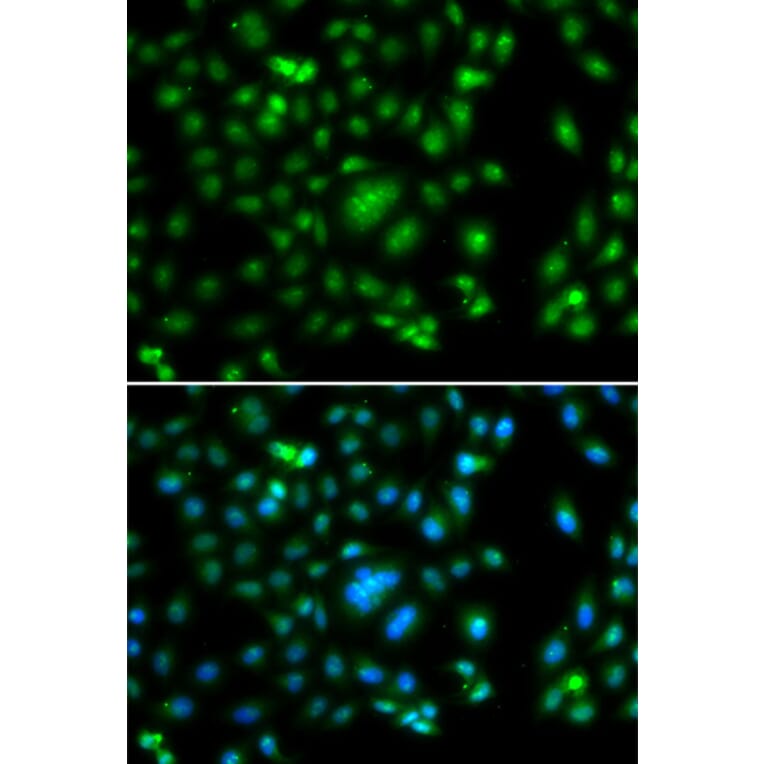 Immunofluorescence - Anti-ELF5 Antibody (A15578) - Antibodies.com