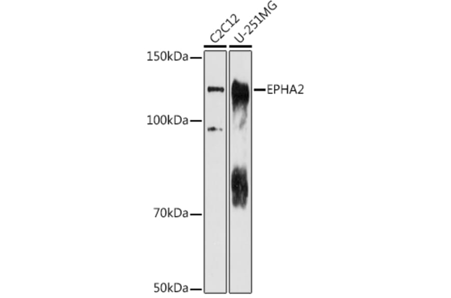 Western Blot - Anti-Eph receptor A2 Antibody (A15580) - Antibodies.com