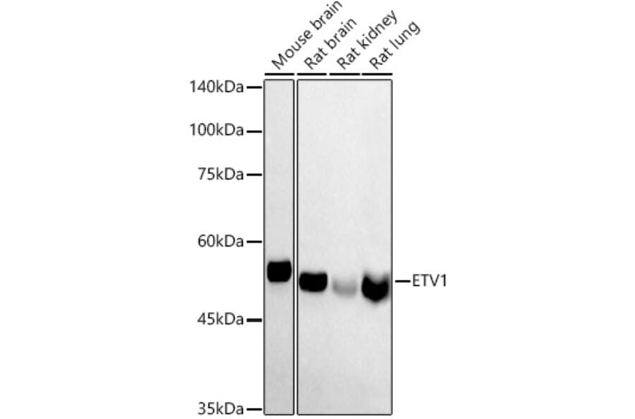 Western Blot - Anti-ER81/ETV1 Antibody (A15581) - Antibodies.com