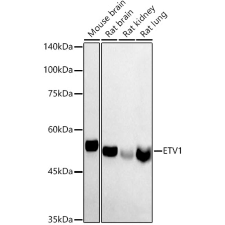 Western Blot - Anti-ER81/ETV1 Antibody (A15581) - Antibodies.com