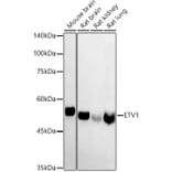 Western Blot - Anti-ER81/ETV1 Antibody (A15581) - Antibodies.com