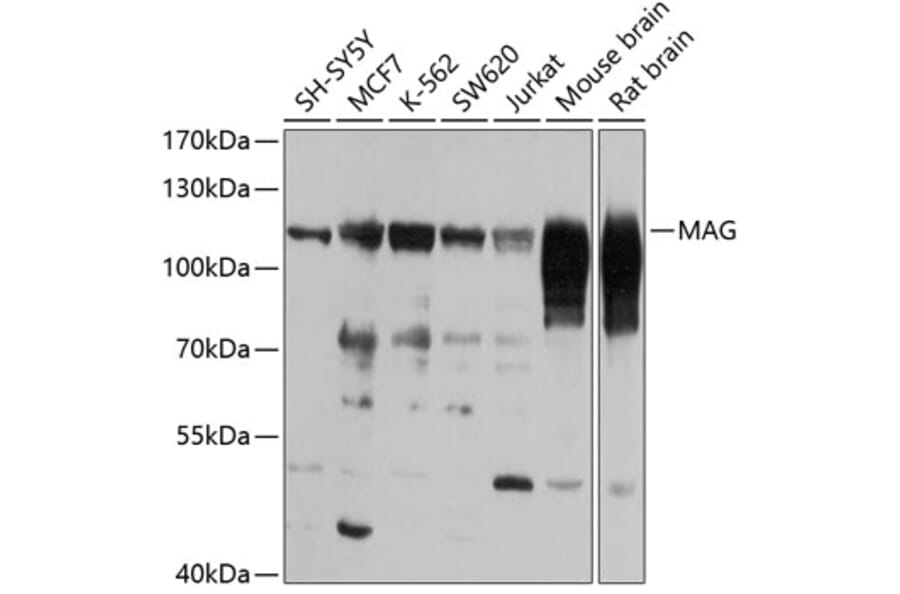 Western Blot - Anti-MAG/GMA Antibody (A15582) - Antibodies.com