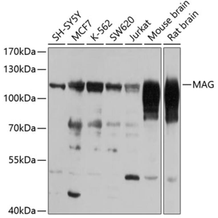 Western Blot - Anti-MAG/GMA Antibody (A15582) - Antibodies.com