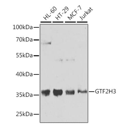 Western Blot - Anti-GTF2H3 Antibody (A15583) - Antibodies.com