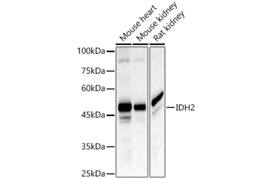 Western Blot - Anti-IDH2 Antibody (A15584) - Antibodies.com