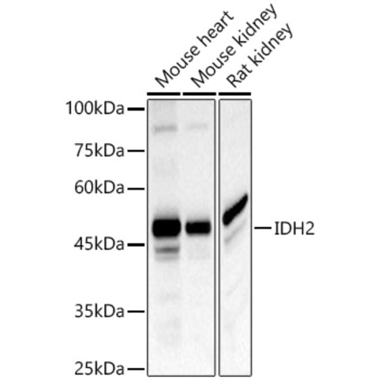 Western Blot - Anti-IDH2 Antibody (A15584) - Antibodies.com