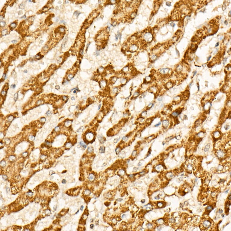Immunohistochemistry - Anti-IDH2 Antibody (A15584) - Antibodies.com
