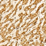 Immunohistochemistry - Anti-IDH2 Antibody (A15584) - Antibodies.com