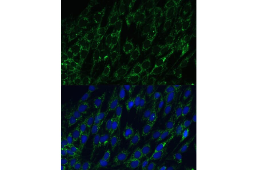 Immunofluorescence - Anti-IDH2 Antibody (A15584) - Antibodies.com