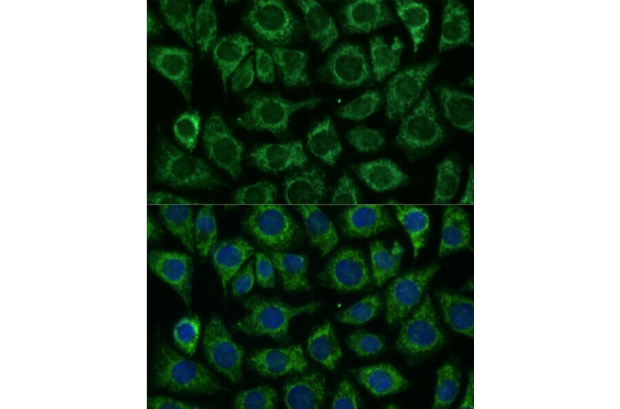 Immunofluorescence - Anti-IDH2 Antibody (A15584) - Antibodies.com
