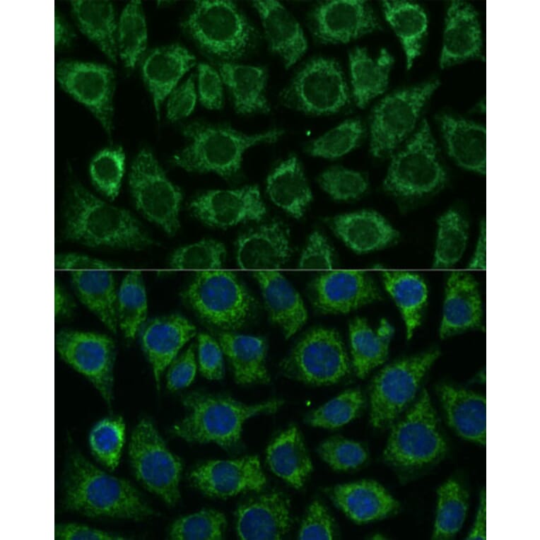 Immunofluorescence - Anti-IDH2 Antibody (A15584) - Antibodies.com