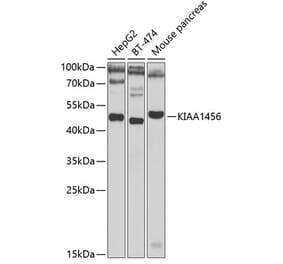 Western Blot - Anti-TRMT9B Antibody (A15585) - Antibodies.com