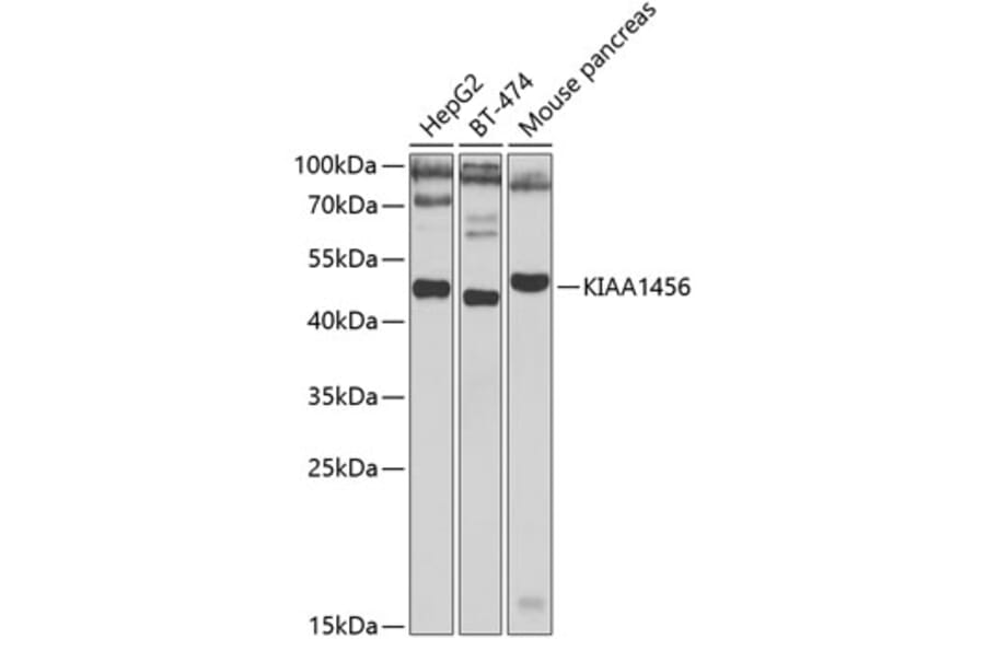 Western Blot - Anti-TRMT9B Antibody (A15585) - Antibodies.com