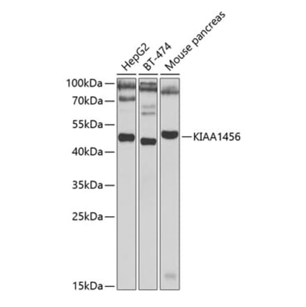 Western Blot - Anti-TRMT9B Antibody (A15585) - Antibodies.com