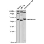 Western Blot - Anti-TRMT9B Antibody (A15585) - Antibodies.com