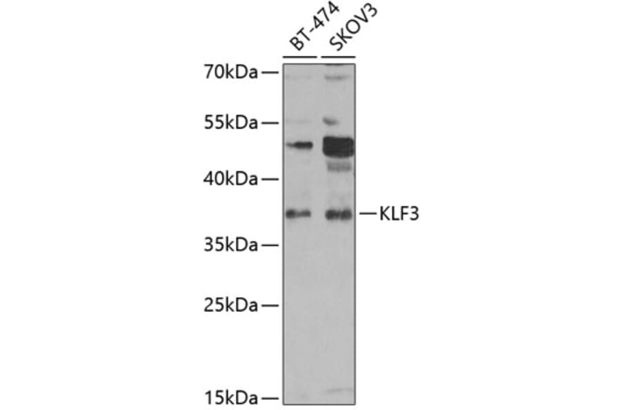 Western Blot - Anti-KLF3 Antibody (A15586) - Antibodies.com