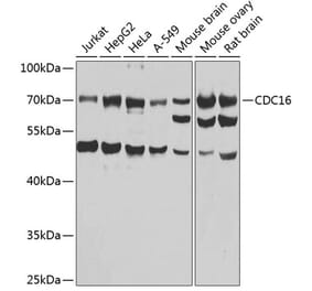 Western Blot - Anti-APC6 Antibody (A15588) - Antibodies.com