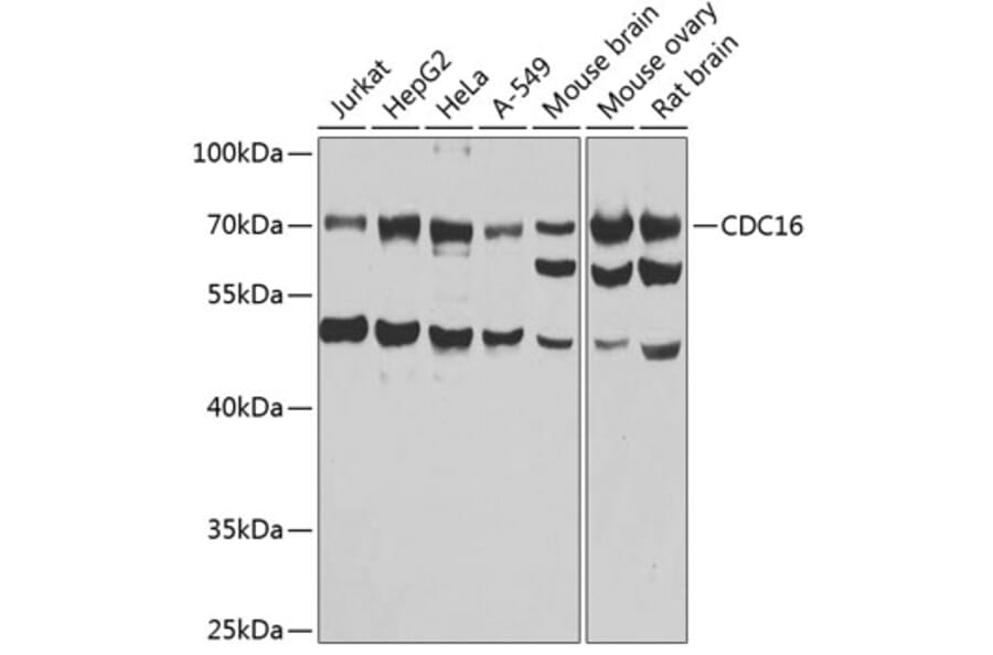 Western Blot - Anti-APC6 Antibody (A15588) - Antibodies.com