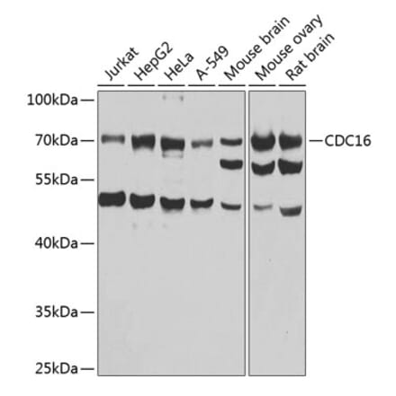 Western Blot - Anti-APC6 Antibody (A15588) - Antibodies.com