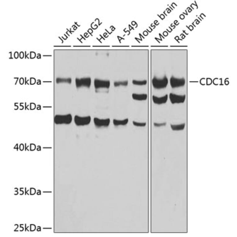 Western Blot - Anti-APC6 Antibody (A15588) - Antibodies.com