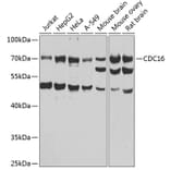Western Blot - Anti-APC6 Antibody (A15588) - Antibodies.com