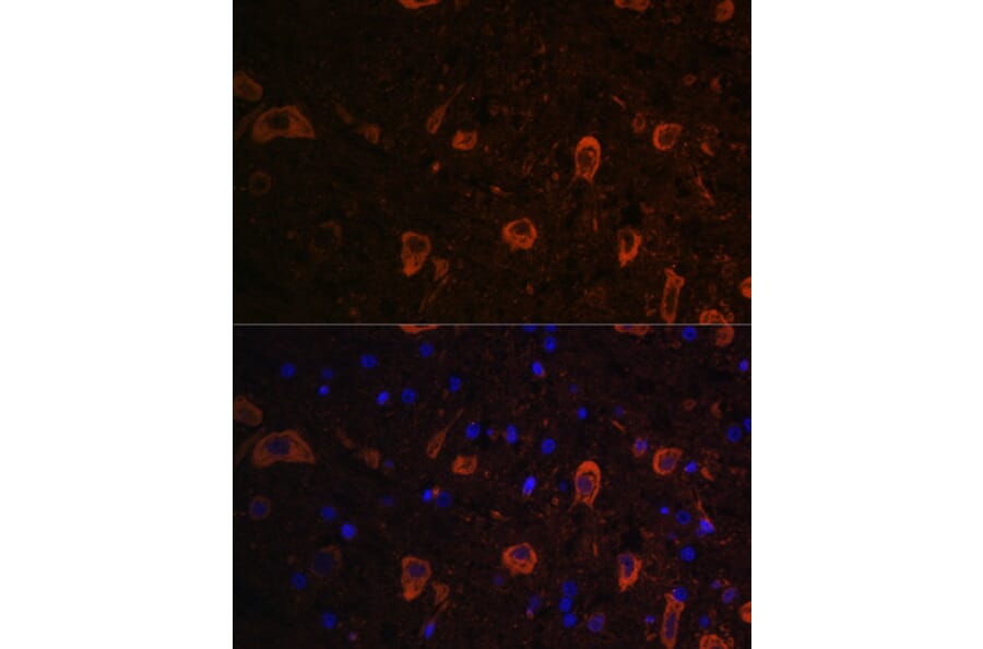 Immunofluorescence - Anti-LC3B Antibody (A15589) - Antibodies.com