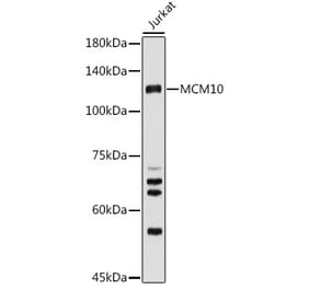Western Blot - Anti-MCM10 Antibody (A15590) - Antibodies.com