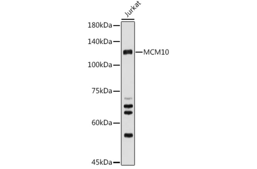 Western Blot - Anti-MCM10 Antibody (A15590) - Antibodies.com