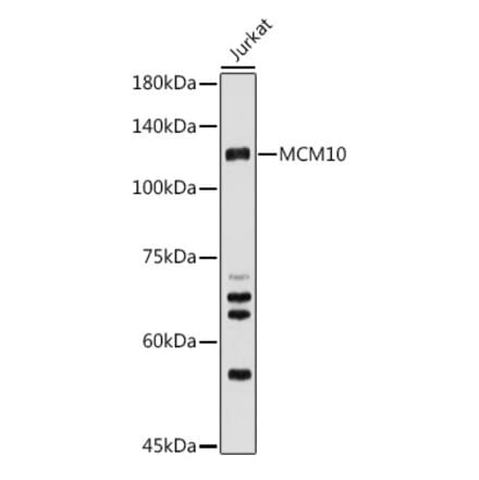 Western Blot - Anti-MCM10 Antibody (A15590) - Antibodies.com
