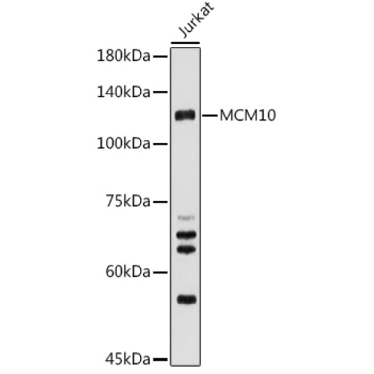 Western Blot - Anti-MCM10 Antibody (A15590) - Antibodies.com