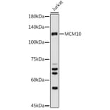Western Blot - Anti-MCM10 Antibody (A15590) - Antibodies.com